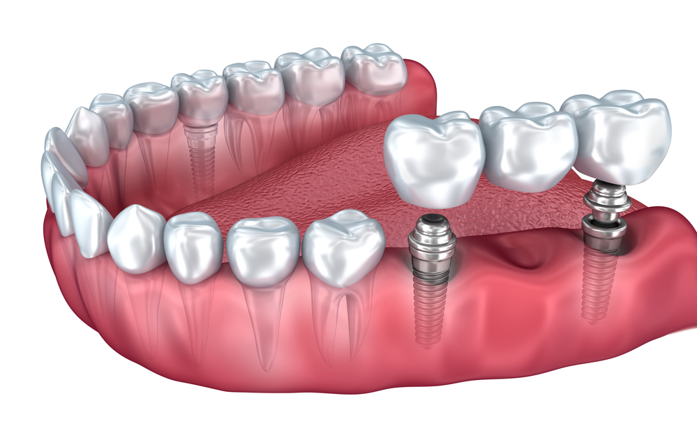 Perion Dental Health Center business image in Tijuana, B.C